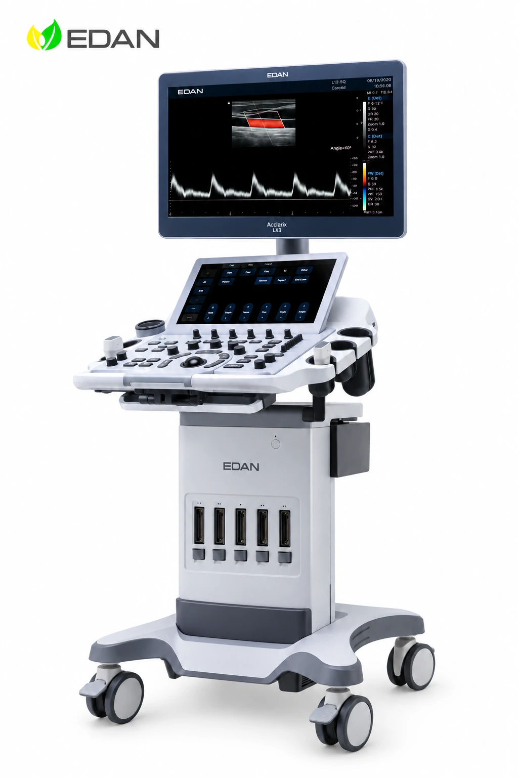 Стационарный УЗИ-аппарат EDAN Acclarix LX3 — внешний вид, вариант исполнения