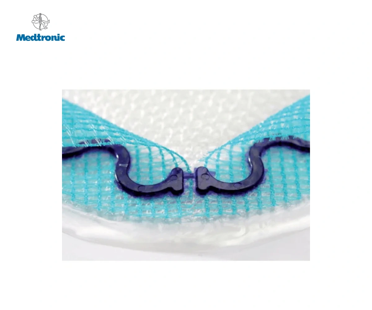 Система PARIETEX COMPOSITE VENTRAL PATCH для герниопластики