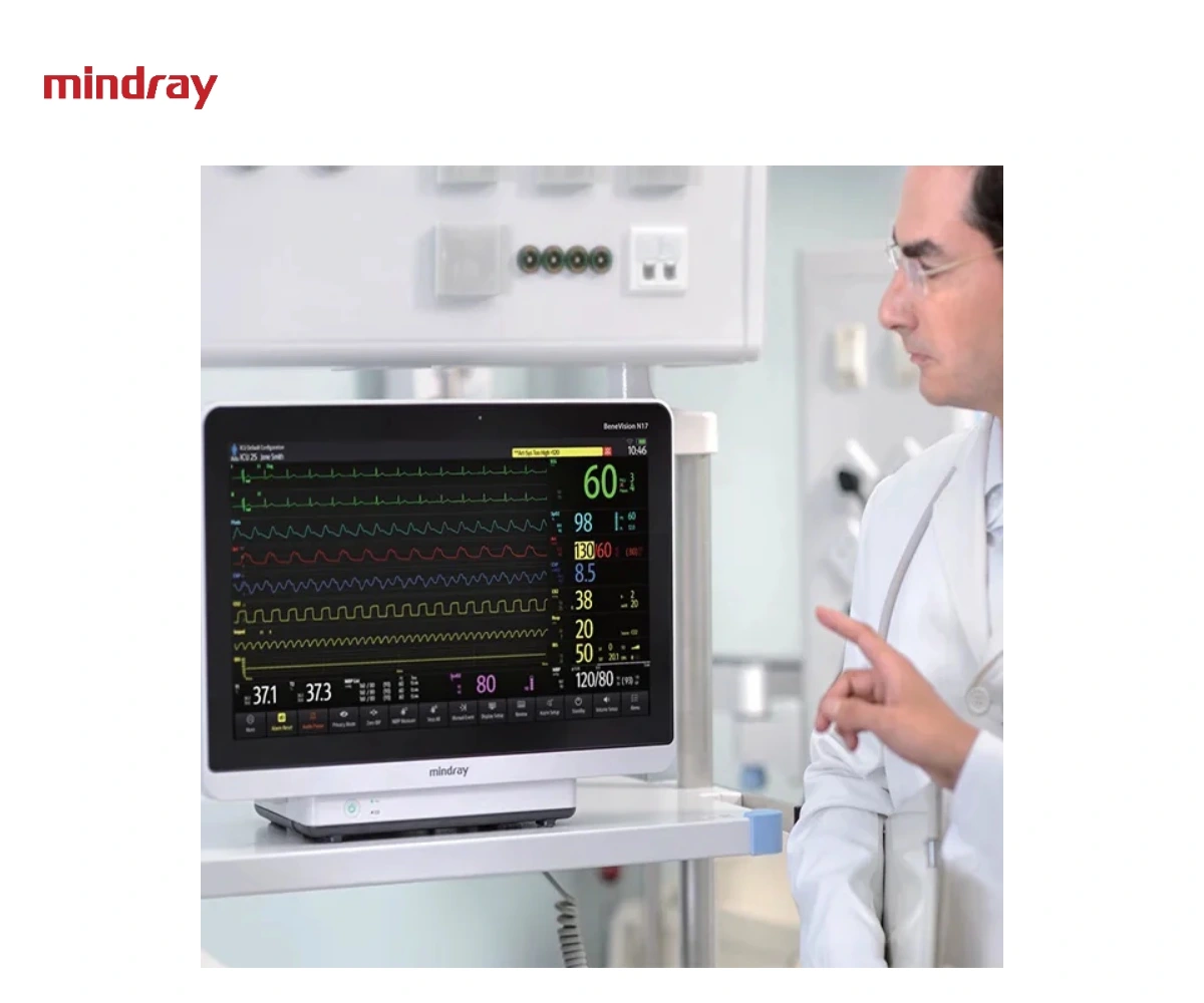 Мониторы пациента Mindray BeneVision N12, N15 и N17 — вид 3