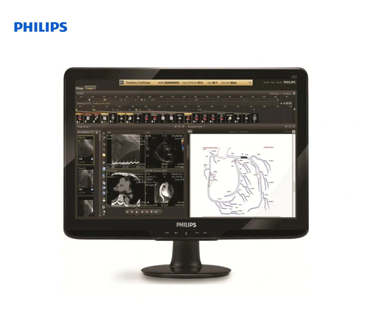 PHILIPS INTELLSPASE CARDIOVASCULAR