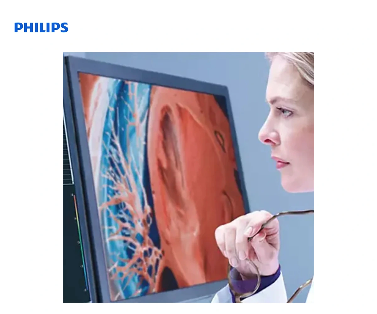 PHILIPS INTELLISPACE PORTAL 12