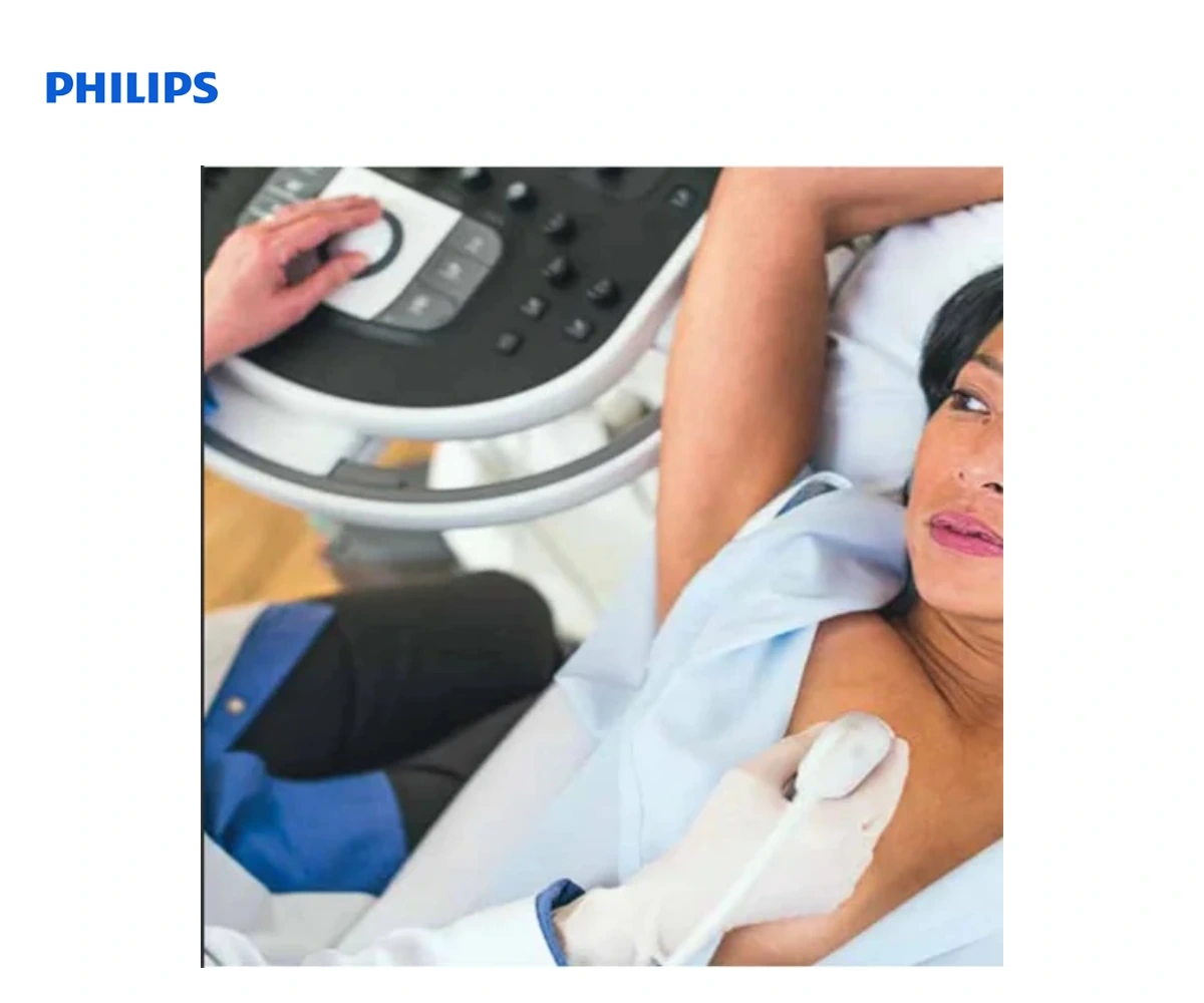 Ультразвуковая система Philips Affiniti 30 — вид 4