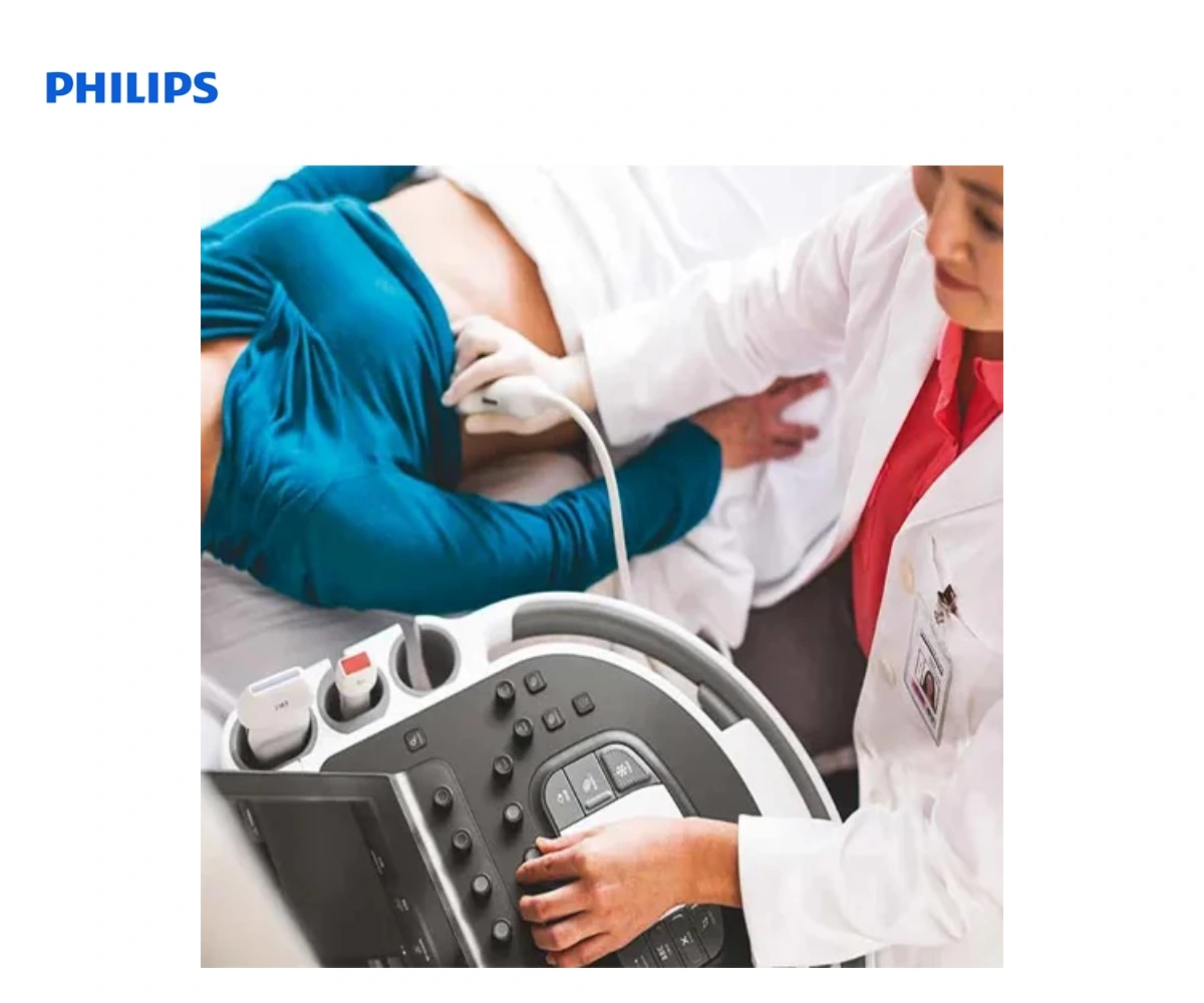 Ультразвуковая система Philips Affiniti 70 — вид 2