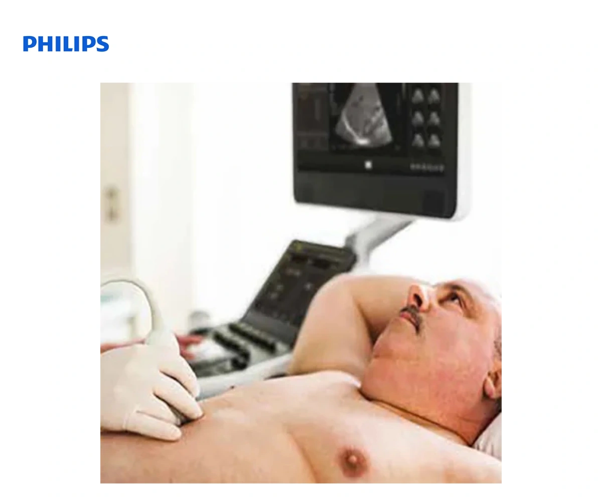 Ультразвуковая система Philips Affiniti 70 — вид 3