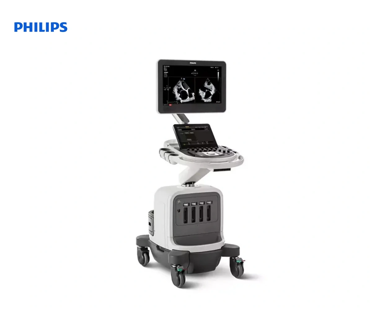 Philips AFFINITI CVX – УЗИ аппарат экспертного класса для кардиологии