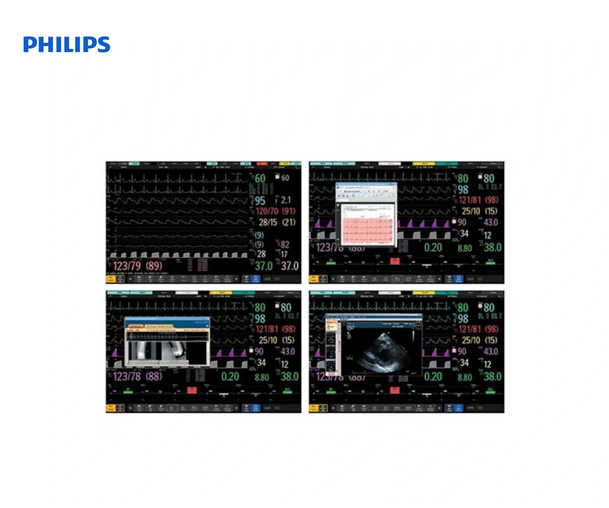 Мониторы пациента Philips IntelliVue MX700 и MX800 — вид 2