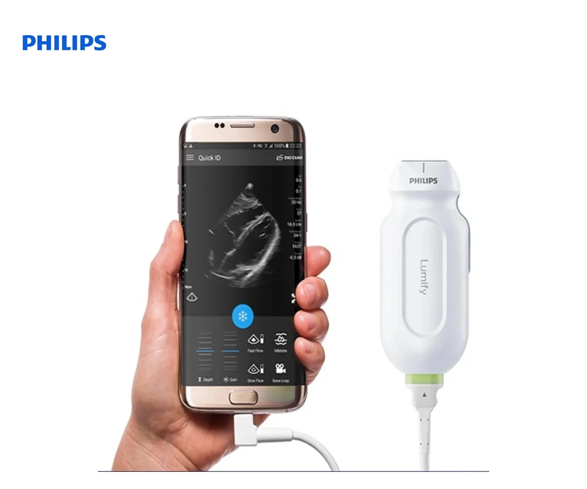 Портативная ультразвуковая система Philips Lumify — вид 5