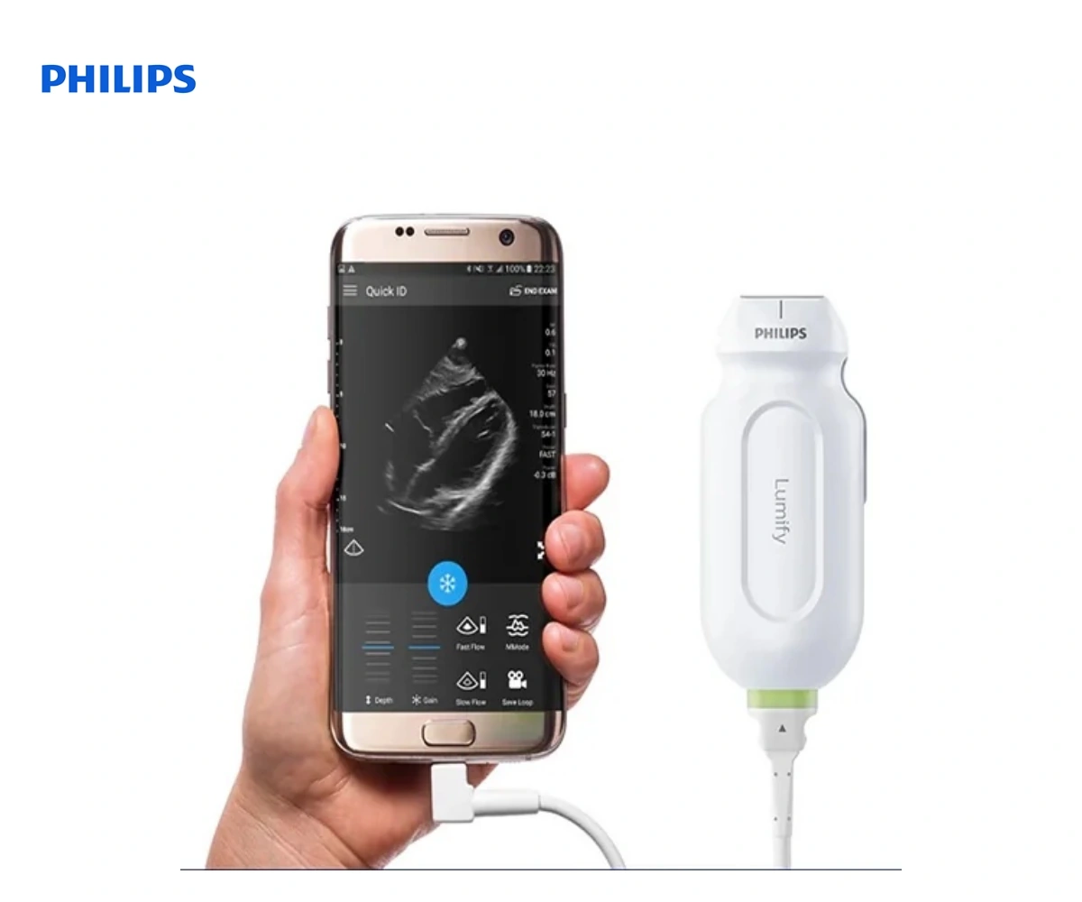 Портативная ультразвуковая система Philips Lumify