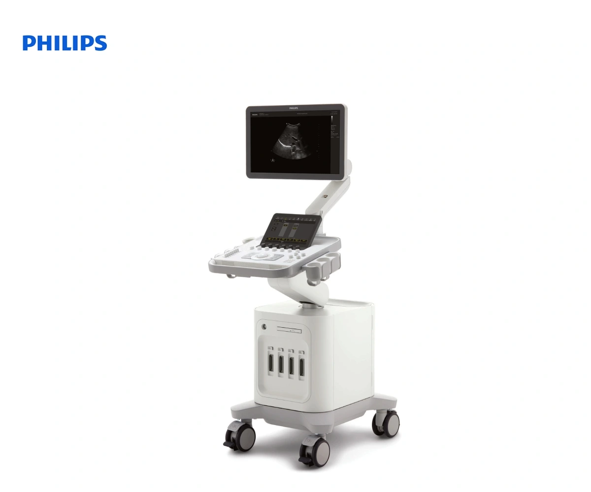 УЗИ-аппарат Philips 3300 для общих исследований