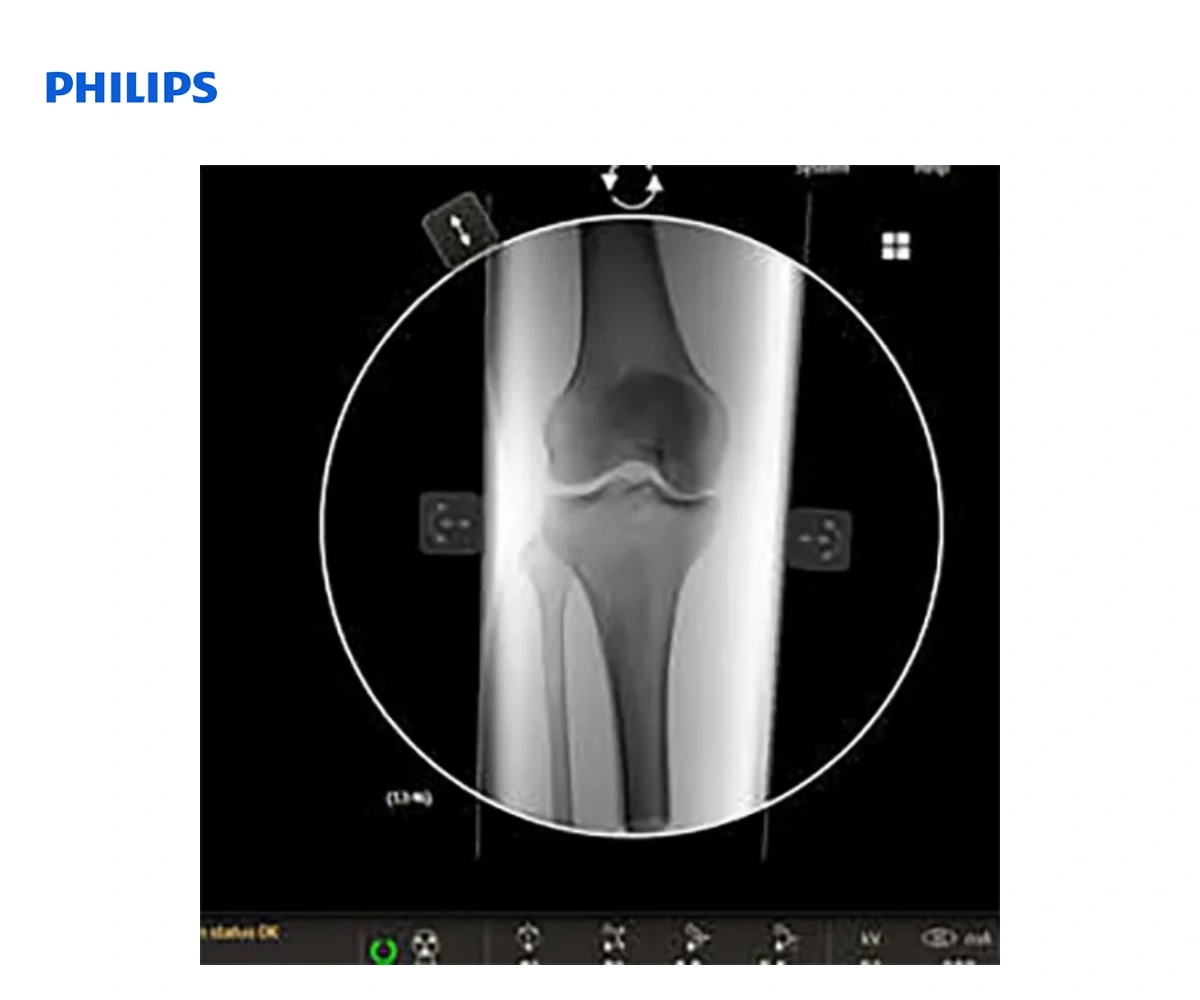 Мобильная С-дуга Philips Veradius Unity — вид 4