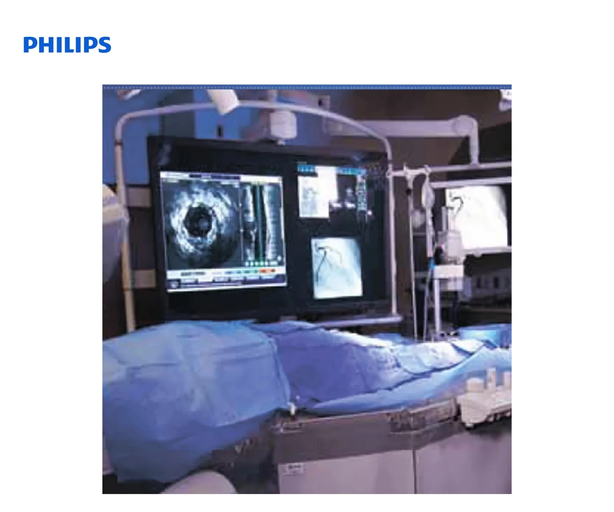 PHILIPS VOLCANO CORE: интегрированная всузи IFR FFR