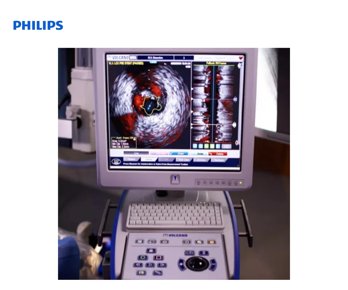 PHILIPS VOLCANO CORE: всузи, IFR и FFR мобильный