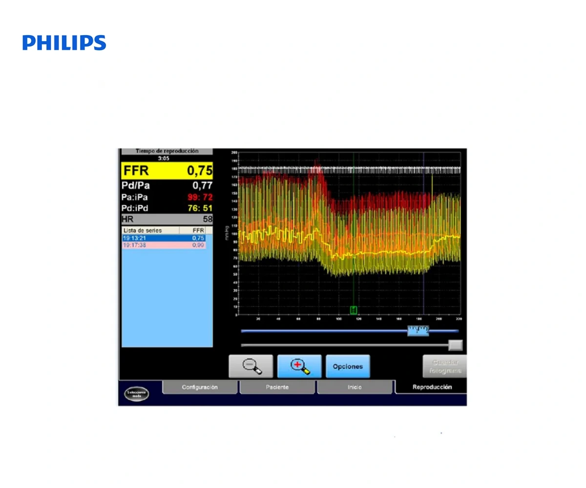 PHILIPS VERRATA PLUS: проводник с датчиком давления