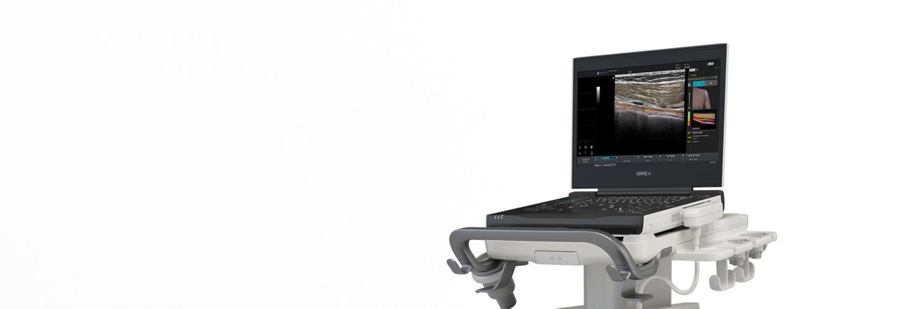 GE HealthCare LOGIQ e X