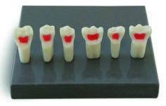 GF Dental EK1/P — учебные детские зубы для пульпэктомии