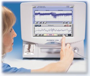 Монитор церебральных функций «Olympic CFM 6000»